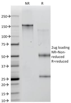 Mouse anti-CD35, Clone: E11, Novus Biologicals 0.2mg; Unlabeled:Antibodies,